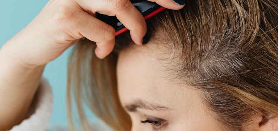 フケを解消する