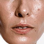 脂性肌向けスキンケア